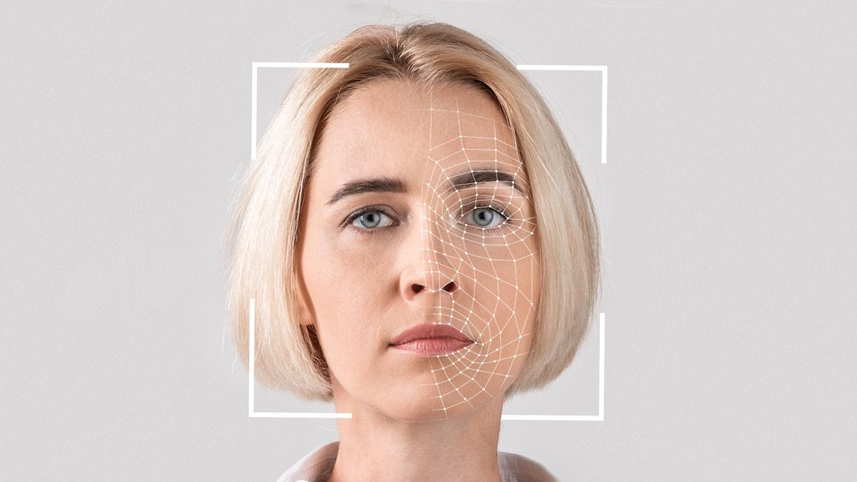 Chica con paralisis facial