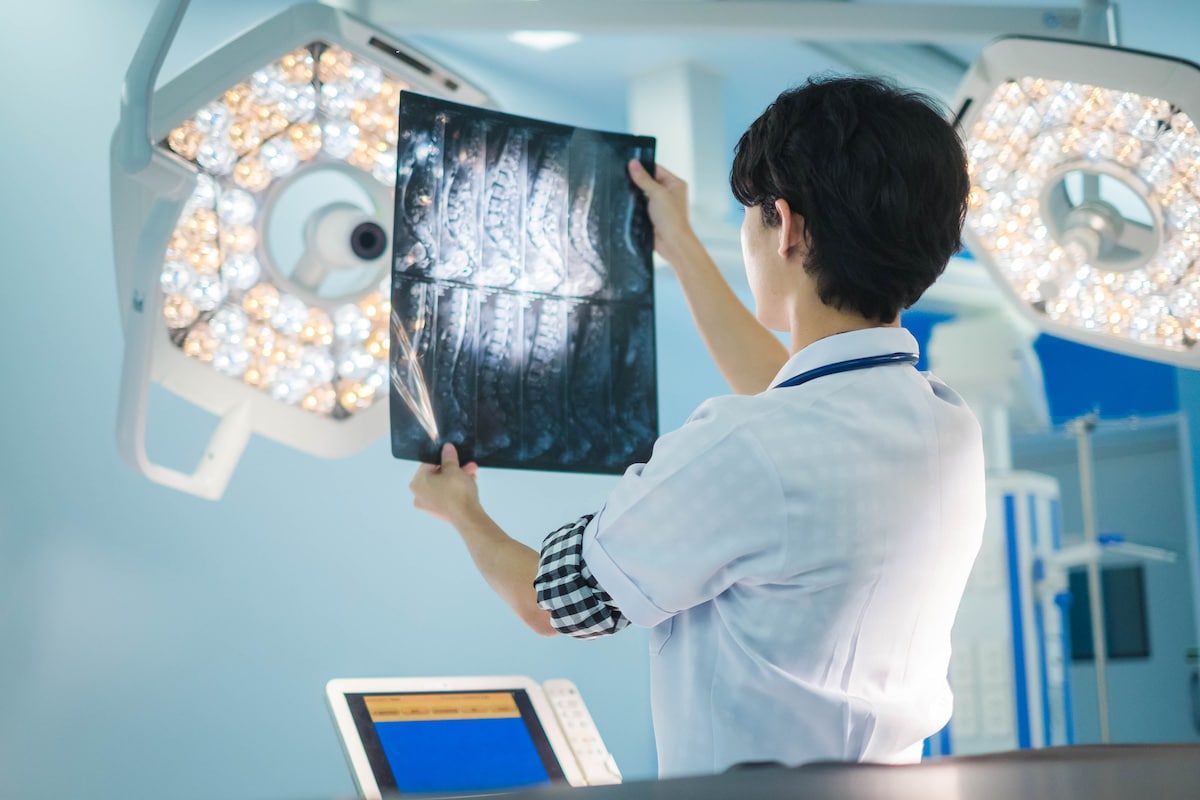Doctor revisando los rayos x de un paciente con atrofia muscular espinal